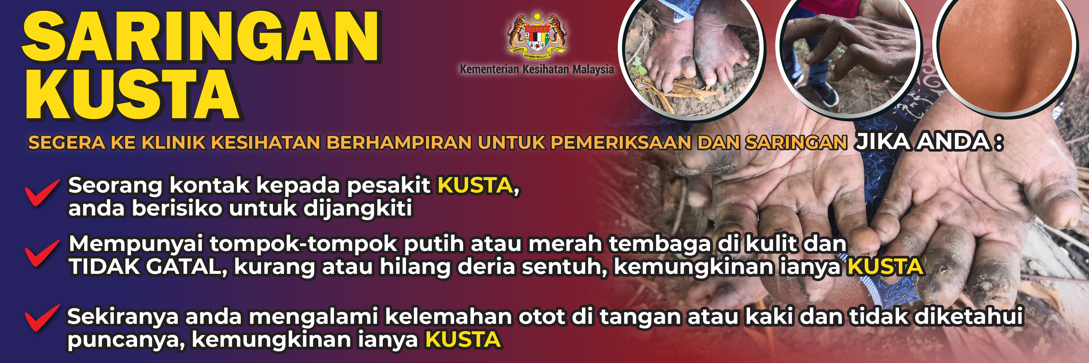 Portal Rasmi Kementerian Kesihatan Malaysia