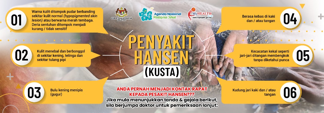 Portal Rasmi Kementerian Kesihatan Malaysia